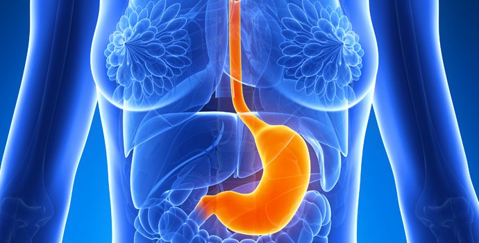 comment soigner reflux gastrique