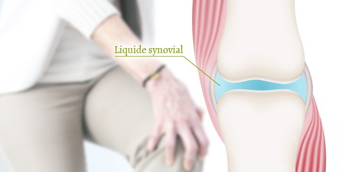 Arthrose : osez la glucosamine-chondroïtine