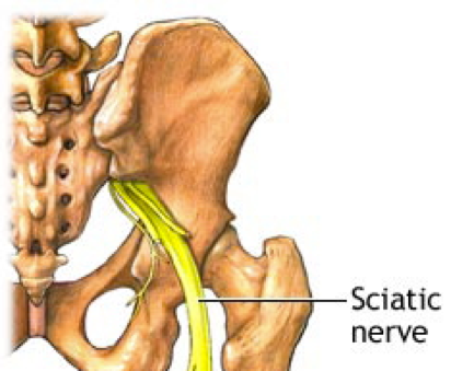 Nerf Sciatique : voici comment soulager sa sciatique naturellement