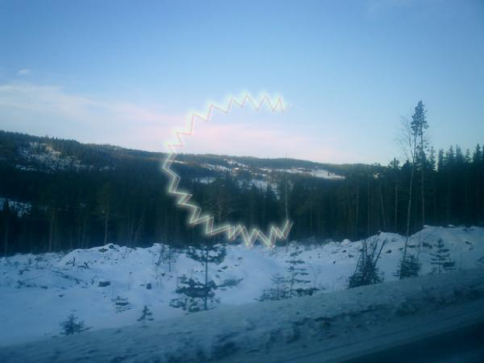 scotome scintillant