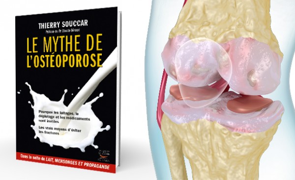 SNI_osteoporose-livre